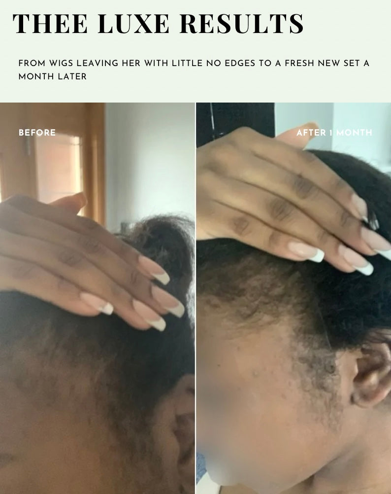 Thee Growth Serum